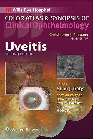 Download Uveitis (Color Atlas and Synopsis of Clinical Ophthalmology) - Sunir J. Garg file in PDF